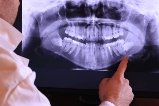 Best Emergency Cosmetic Dentistry in San Marcos, TX