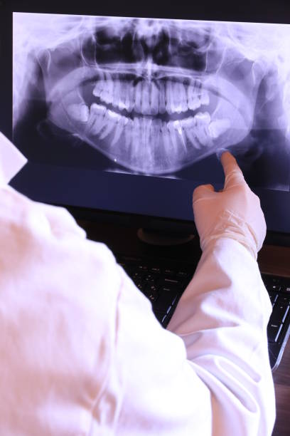 Best Emergency Root Canal Treatment in San Marcos, TX