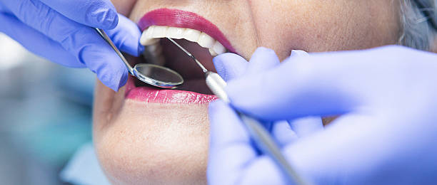 Best Emergency Dental Services for Seniors in San Marcos, TX